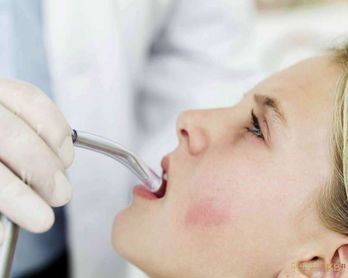 5岁乳牙患龋率66 口腔疾病成市民主要健康问题